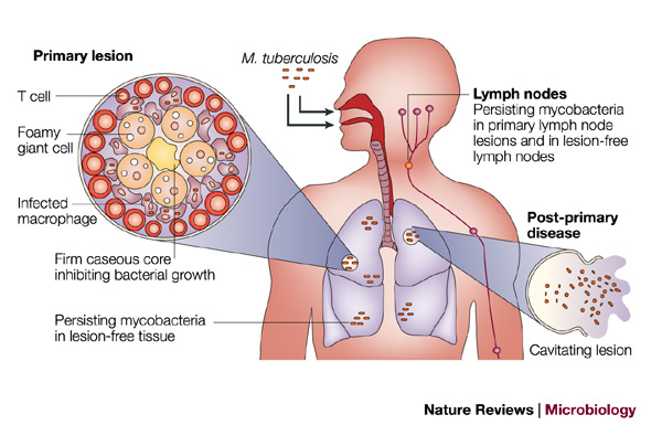 Tuberkolosis/tuberkolosis.org